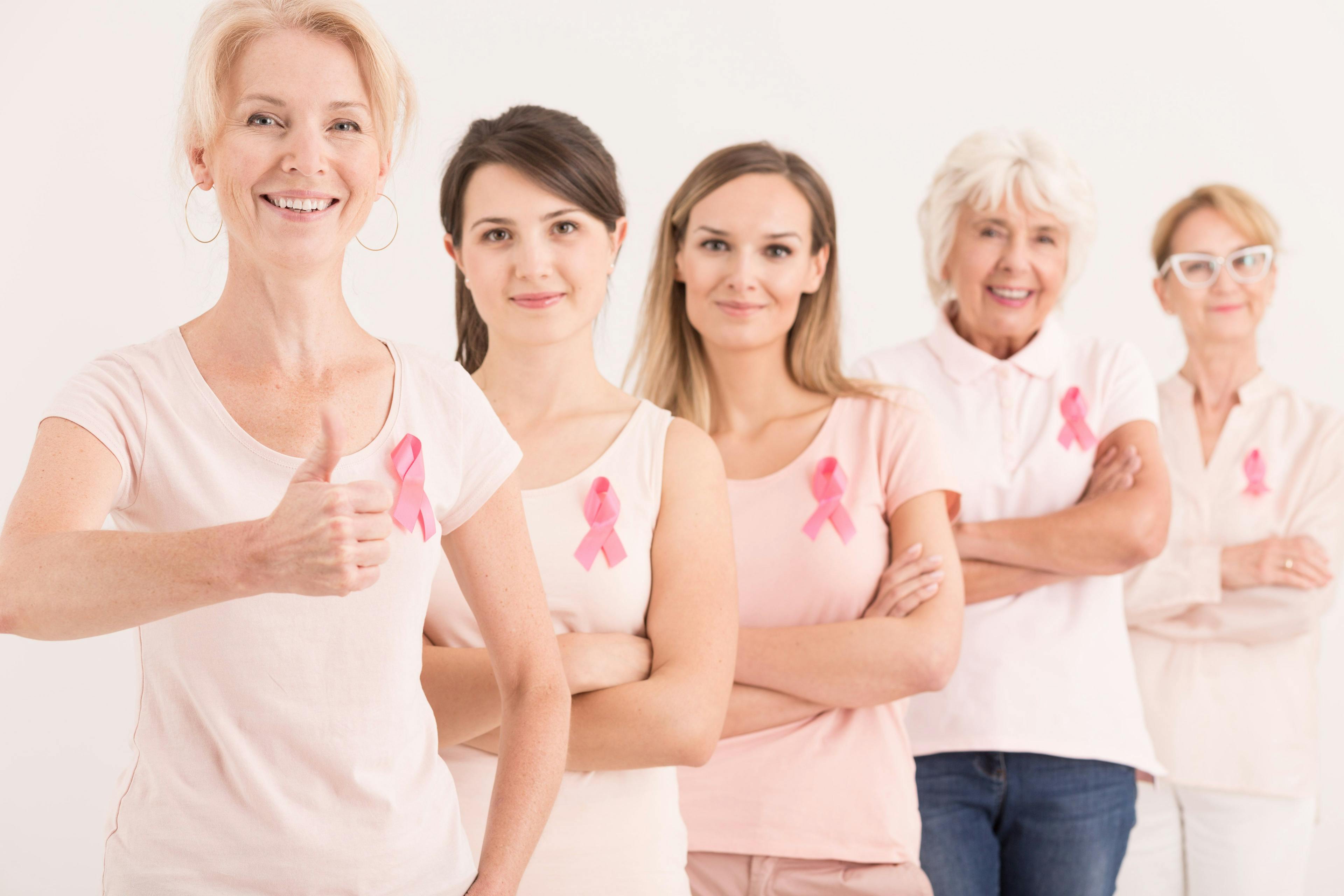 Fünf Frauen machen auf das Thema Brustkrebs aufmerksam.